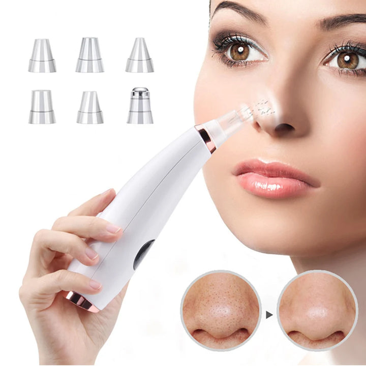 Electric Blackhead Remover and Acne Cleanser